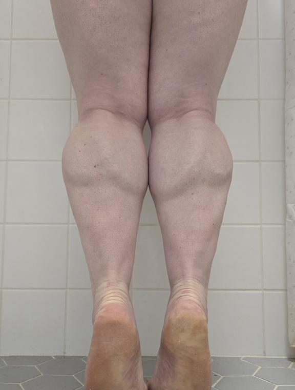NothingButCalves Onlyfans pictures